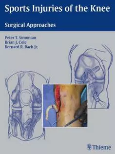 Sports Injuries of the Knee: Surgical Approaches