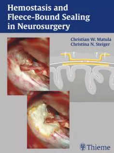 Hemostasis Fleece-Bound Sealants in Neurosurgery