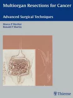Multiorgan Resections for Cancer