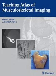Teaching Atlas of Musculoskeletal Imaging