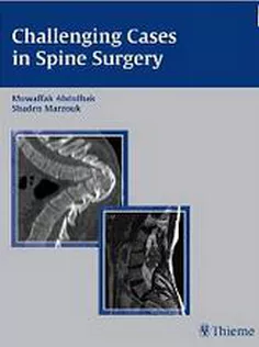Challenging Cases in Spine Surgery