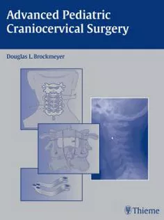 Advanced Pediatric Craniocervical Surgery
