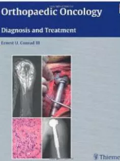 Orthopaedic Oncology Diagnosis And Treatment