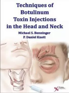 Techniques of Botulinum Toxin Injections in the Head and Neck