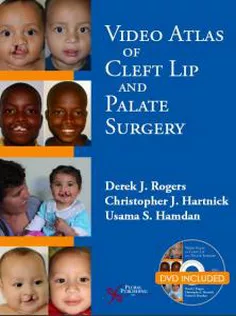 Video Atlas of Cleft Lip and Palate Surgery