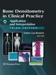 Bone Densitometry in Clinical Practice: Application and Interpretation