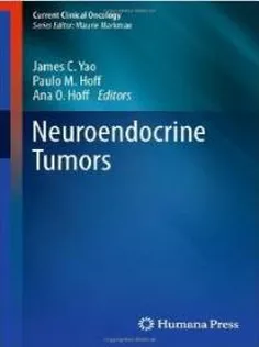 Neuroendocrine Tumors
