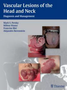 Vascular Lesions of the Head and Neck: Diagnosis and Management