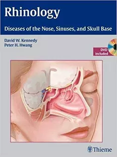 Rhinology Diseases of the Nose, Sinuses,and Skull Base