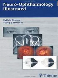 Neuro-Ophthalmology Illustrated