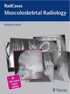 Musculoskeletal Radiology
