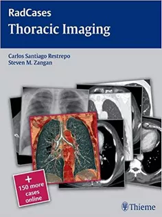 Rad Cases Thoracic Imaging