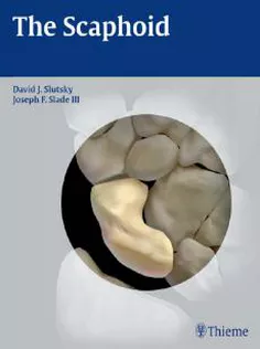 The Scaphoid