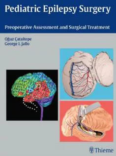 Pediatric Epilepsy Surgery