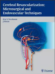 Cerebral Revascularization: Microsurgical and Endovascular Techniques