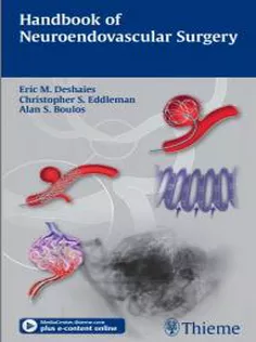 Handbook of Neuroendovascular Surgery