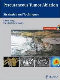 Percutaneous Tumor Ablation