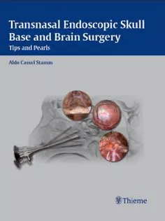 Transnasal Endoscopic Skull Base & Brain Surgery: Tips & Pearls