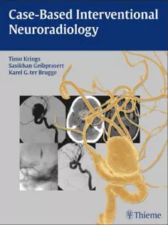 Case-Based Interventional Neuroradiology