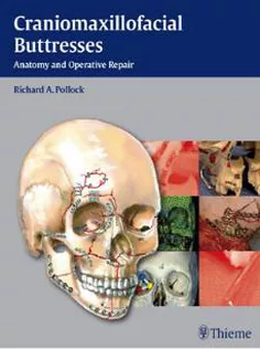 Craniomaxillofacial Buttresses