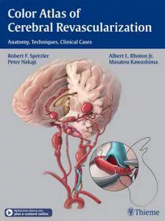 Color Atlas of Cerebral Revascularization: Anatomy,Techniques,Clinical Cases
