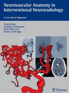 Neurovascular Anatomy in Interventional Neuroradiology:A Case-Based Approach