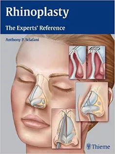 Rhinoplasty: The Experts' Reference