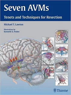 SEVEN AVMs Tenets and Techniques for Resection
