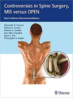 Controversies in Spine Surgery, MIS Versus OPEN