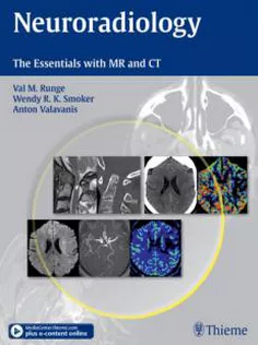 Neuroradiology: The Essentials with MR and CT1