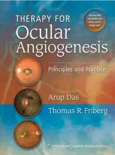 Therapy for Ocular Angiogenesis: Principles and Practice