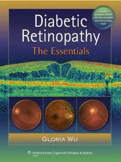 Diabetic Retinopathy: The Essentials