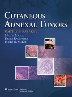Cutaneous Adnexal Tumors
