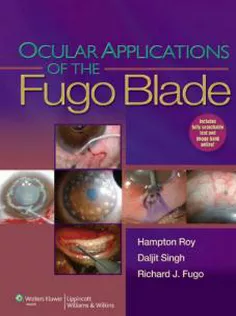 Ocular Applications of the Fugo Blade