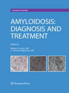 Amyloidosis :Diagnosis and Treatment