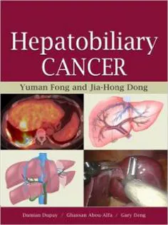 Hepatobiliary Cancer