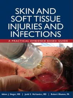 Skin and Soft Tissue Injuries & Infections