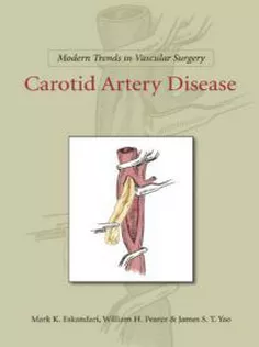 Modern Trends in Vascular Surgery: Carotid Artery Disease