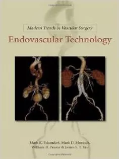 Modern Trends in Vascular Surgery: Endovascular Technology