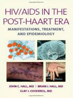 HIV/AIDS in the Post-HAART Era: Manifestations, Treatment, Epidemiology