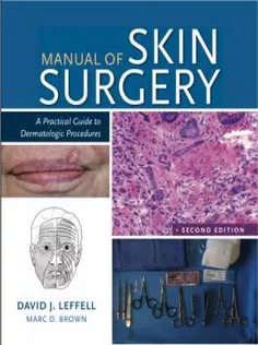 Manual of Skin Surgery: A Practical Guide to Dermatologic Procedures