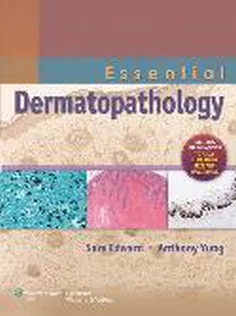 Essential Dermatopathology