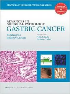 Advances in Surgical Pathology: Gastric Cancer