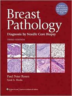 Breast Pathology Diagnosis by Needle Core Biopsy
