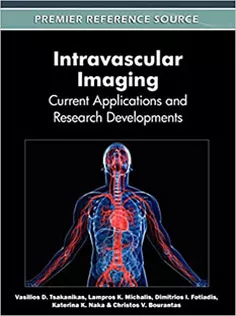 Intravascular Imaging: Current Applications and Research Developments