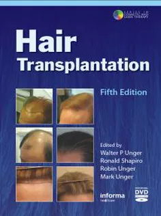Hair Transplantation + Video DVD