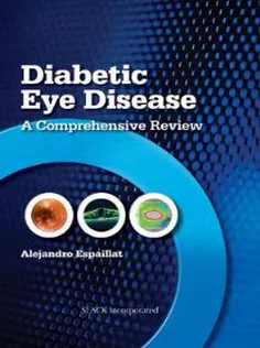 9781617110108 Diabetic Eye Disease: A Comprehensive Review