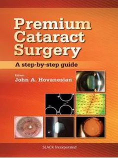 Premium Cataract Surgery: A Step-by-Step Guide