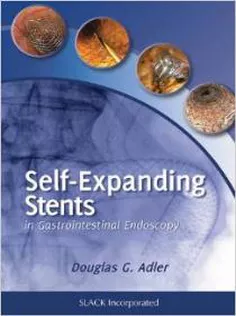 9781617110283 Self-Expanding Stents in Gastrointestinal Endoscopy