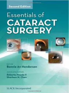 Essentials of Cataract Surgery